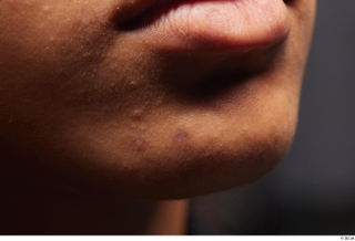 HD Face Skin Umaira chin face lips mouth skin pores…